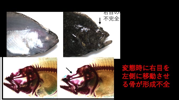ヒラメ異常個体の眼位異常と骨格形成不全